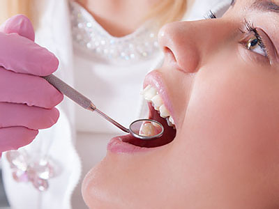 KayCare Family Dental | Dentures, Crowns  amp  Caps and Dental Fillings